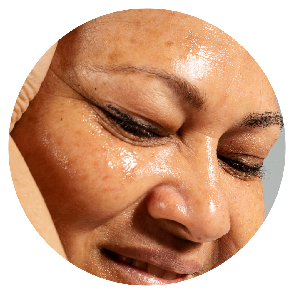 Oily Skin